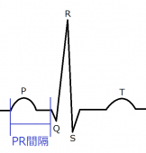 PR間隔（心電図の特徴）